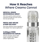 Derma Renewal Lab PDRN Micro-Infusion System